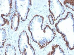 Cytokeratin 13 Antibody (KRT13/2659) - Azide and BSA Free, Novus Biologicals 100 &mu;g | Buy Online | Novus Biologicals | Fisher Scientific
